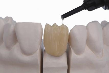 Make sure to provide adequate space for the subsequent application of translucent and incisal materials and cure for 1