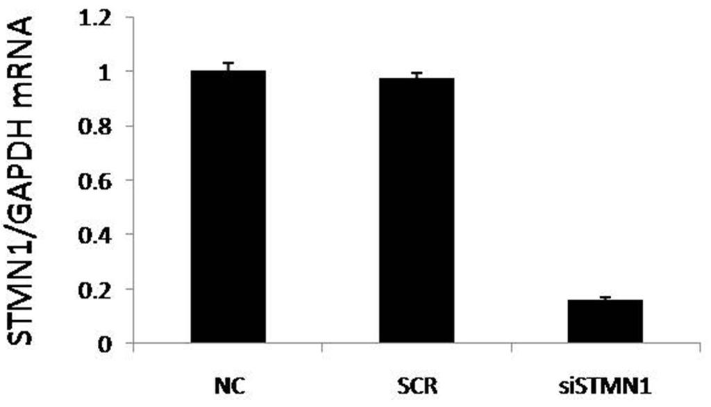 Changes of expression levels of STMN1 protein in esophageal squamous cell carcinoma Eca-109 cells before and after transfection of sirna. β-actin was the internal control gene.