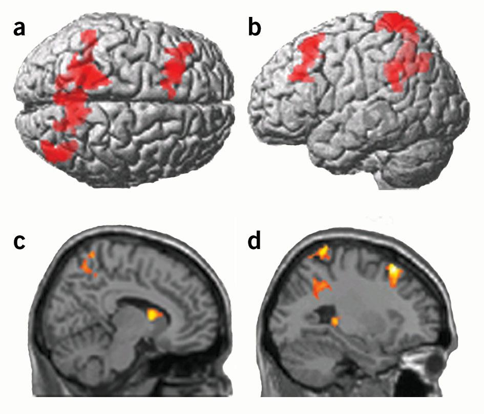 Figure 4 Regions where brain activity correlated with increased working memory capacity (Experiment 2; Table 1). (a) Top view. (b) Left hemisphere.
