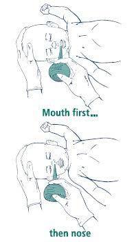 CLEARING AIRWAY NOT ALWAYS NECESSARY Amniotic fluid without meconium: Gently suction or wipe