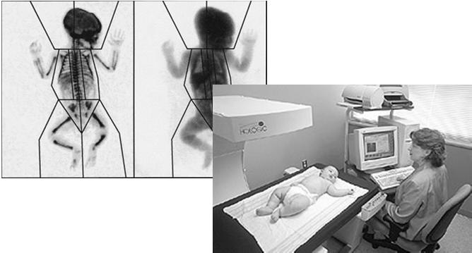 Body Composition Measurement Dual energy x ray absorptiometry