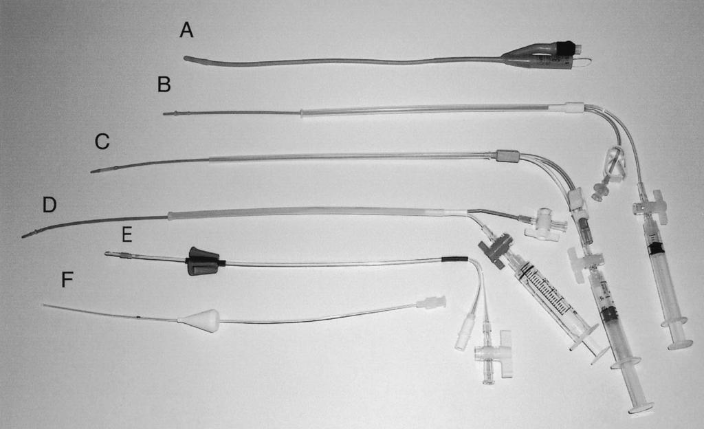 FIGURE 1 (A), Foleycath (Wembley Rubber Products; Sepang, Malaysia; (B), Hysca Hysterosalpinography Catheter (GTA International Medical Devices S.A., La Caleta D.N.