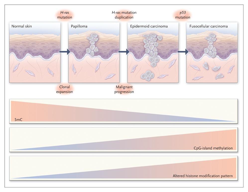 Epigenetic alterations in tumor progression