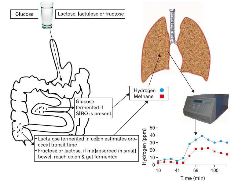 Clinical Use of H 2 -Breath Test Ghoshal UC