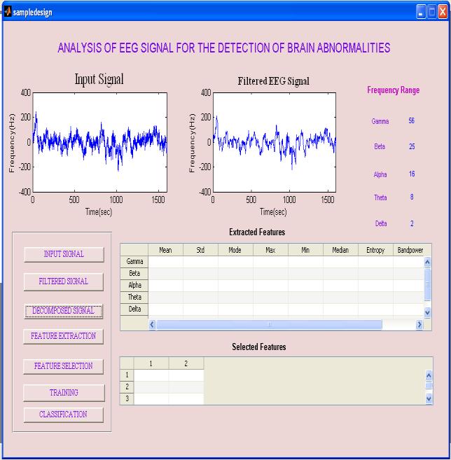 4 shows the frequency range of the decomposed signals. 4.1.2 Results of Feature Extraction Process The EEG signals are non-linear, it represents time vs. frequencies.