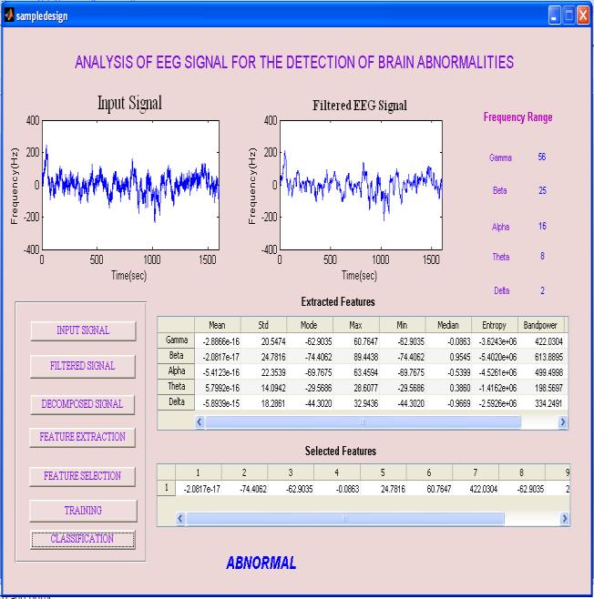 if no data point was reassigned then stop the process. Figure 4.9Classification of Normal Signal Figure 4.8 and 4.9 show the classification of the EEG signal.