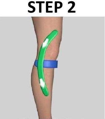 KNEE - LATERAL PAIN For Lateral Pain taping you will need 3 strips 1-6" & 2-8" long. Step 1.