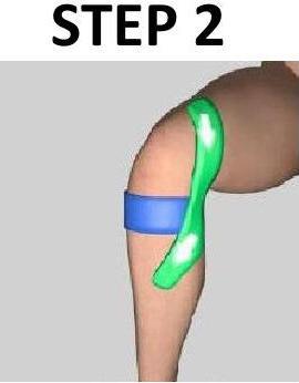 KNEE - MEDIAL PAIN For Medial Pain taping you will need 3 strips 1-6" & 2-8" long. Step 1.