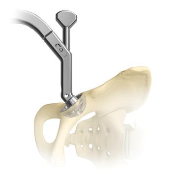 Active Articulation Dual Mobility Hip System Figure 3 Figure 4 Reaming and Cup Trialing M 2 a-magnum Cup Prepare the acetabulum using acetabular reamers, while maintaining the appropriate amount of