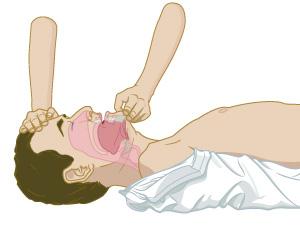 STEP 1 Verify that the victim is unconscious, breathless and pulseless/without circulation.