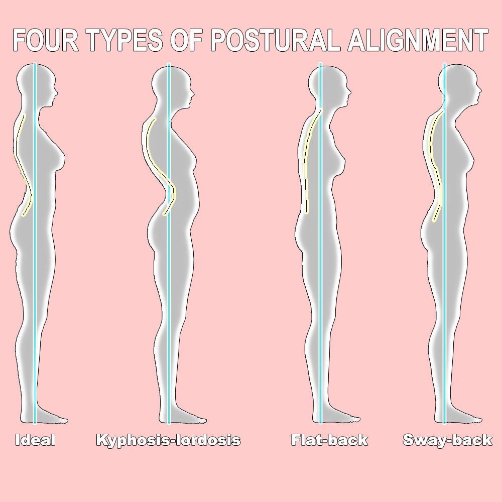 Primary Postural Imbalances: If you think about your skull and spine as the center points for your skeleton, or bone structure, then these curves will