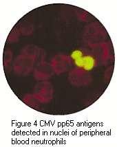 CMV pp65 antigenaemia test (Virology
