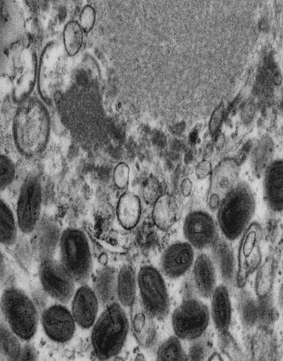 smallpox virus cytoplasmic assembly and maturation F. A.