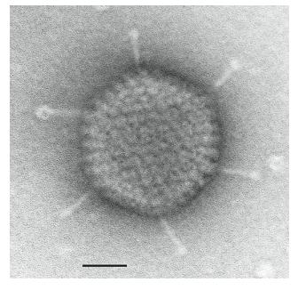 Large complex capsids Adenovirus 150 nm T=25 capsid, 720