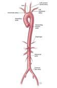 of Michigan Ann Arbor, Michigan The Aorta: Anatomic Definitions Aortic root: Includes AV annulus, AV cusps, sinuses of Valsalva Ascending aorta: Begins at STJ and extends to brachiocephalic artery
