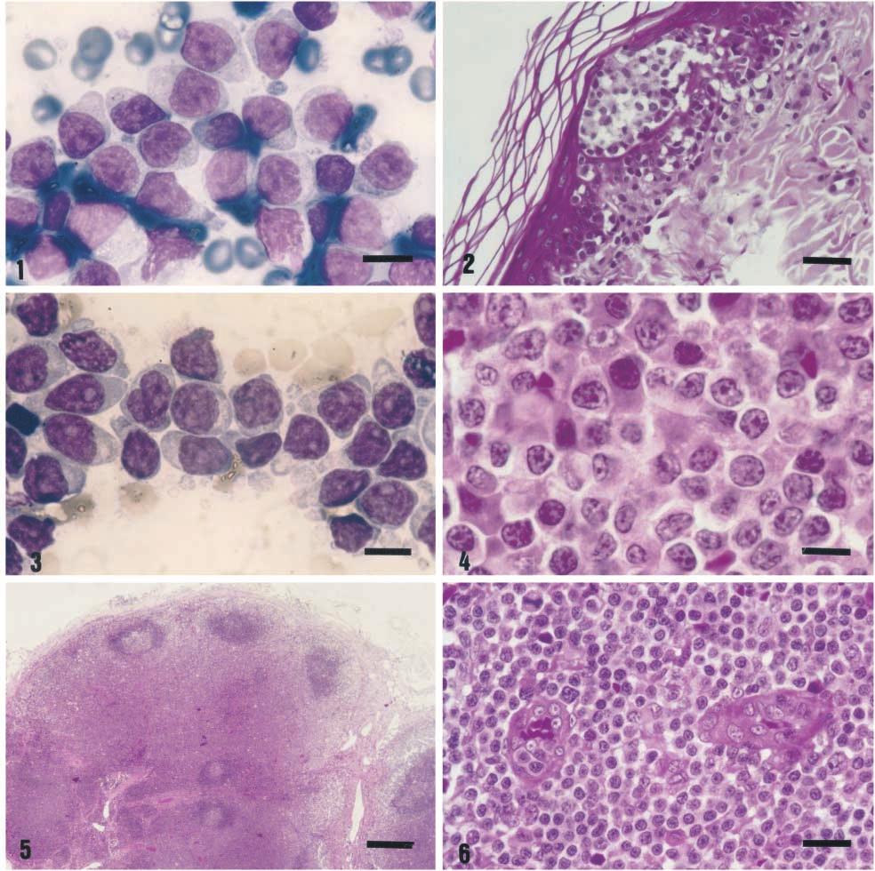 98 Fournel-Fleury et al. Vet Pathol 39:1, 22 Fig. 1. Mycosis fungoides. Large granular lymphocyte type. FNA. Note cytoplasmic azurophilic granules and some cleaved, more or less convoluted nuclei.