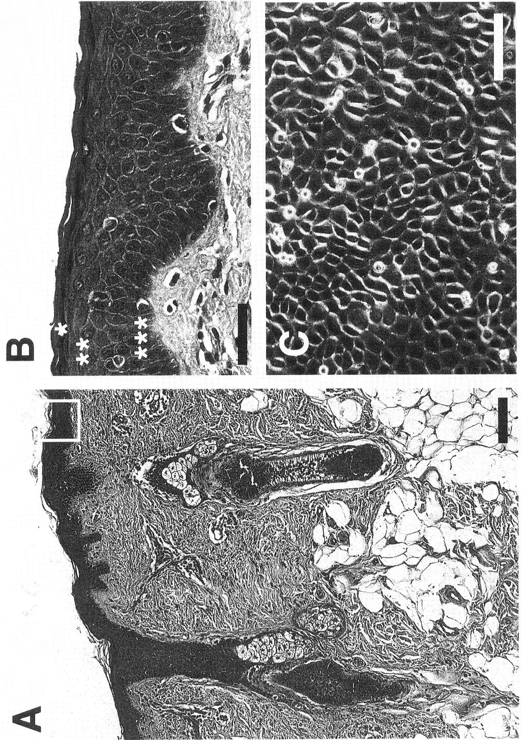 Fig. 2. Heterogeneous structure of the epidermis is constructed of one type of cell, keratinocyte. A: Light microscopic observation of the whole human skin. White box, top right, is the epidermis.