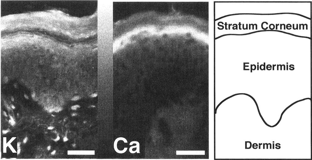 Skin Barrier Function as a Self-Organizing System 231 Fig. 3. Distribution of potassium and calcium in human epidermis. Calcium was stained with Calcium Green 1 and potassium with PBFI.