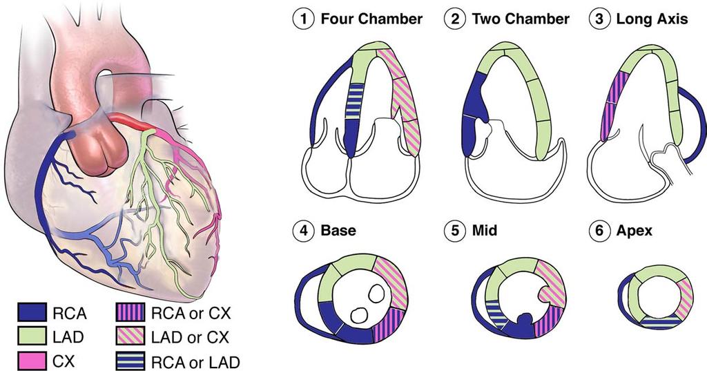 Recommendations for chamber quantification 93 Figure 9 Artist s diagram showing the position of three long axis views and one short axis view of the left ventricle, showing the typical distributions