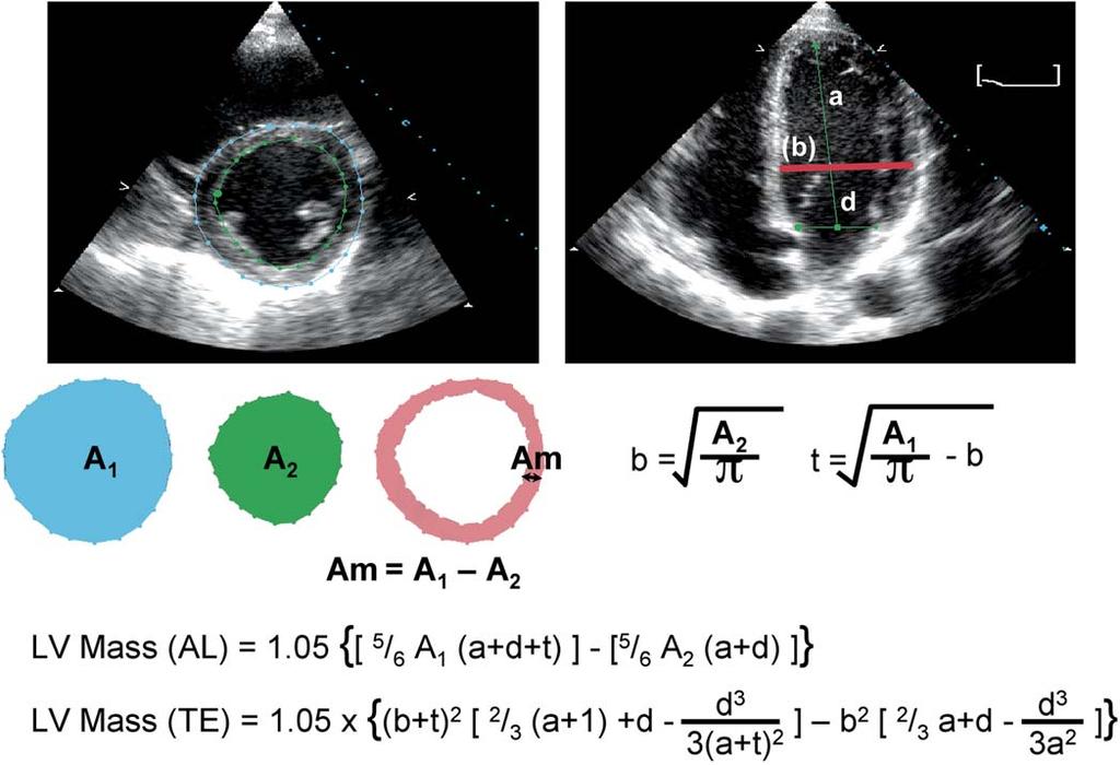 Recommendations for chamber quantification 87 area (A m ) is computed as the difference: A m ¼ A 1 ÿ A 2.