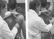 retraction Kibler: AJSM 06 Scapular Assistance Test Assist the scapula retract and upwardly rotate as the arm is