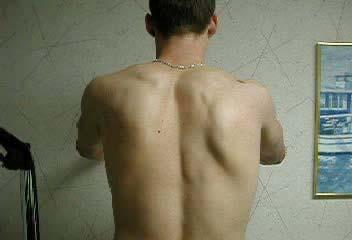 scapula Scapular dyskinesis: what is
