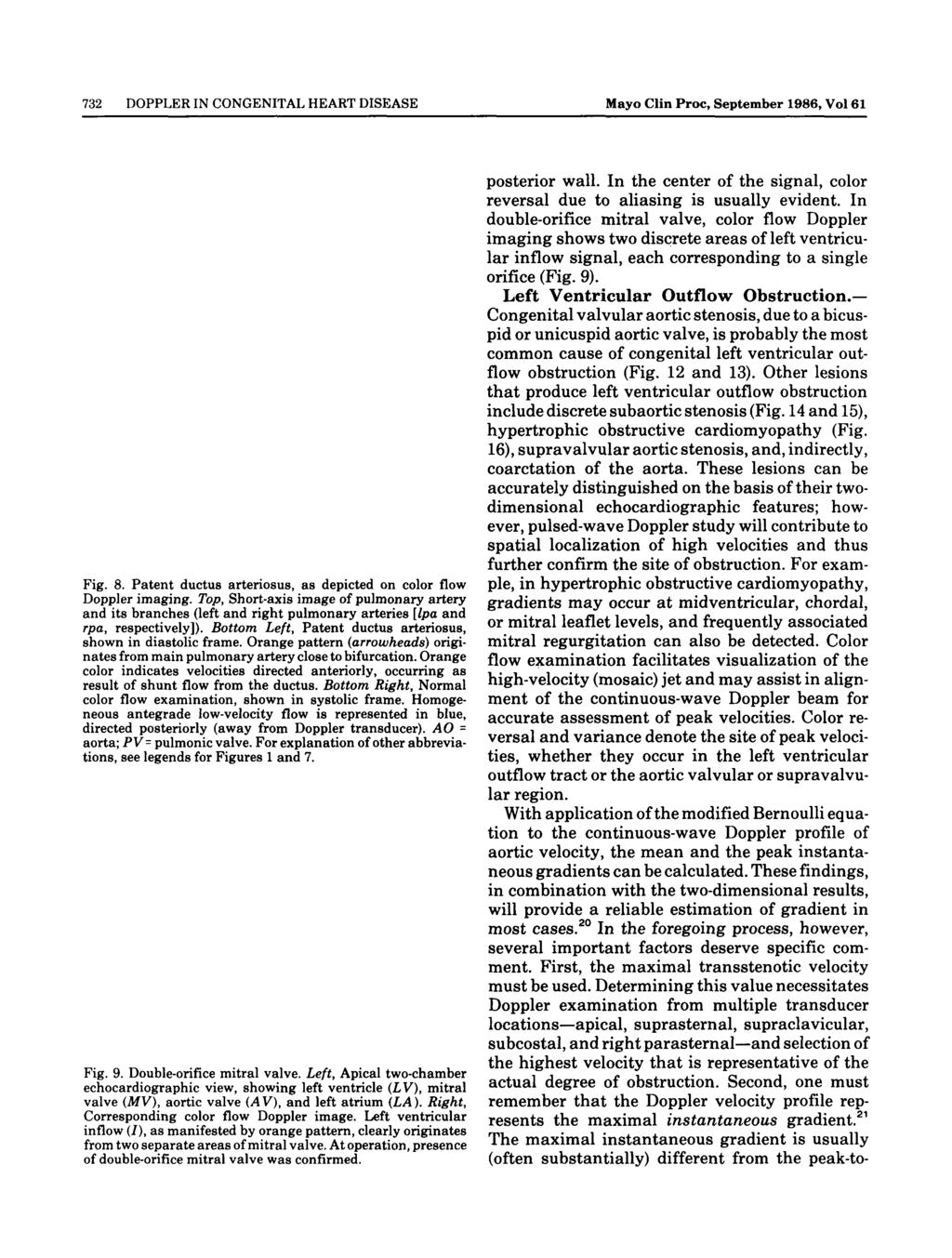732 DOPPLER IN CONGENITAL HEART DISEASE Mayo Clin Proc, September 1986, Vol 61 Fig. 8. Patent ductus arteriosus, as depicted on color flow Doppler imaging.