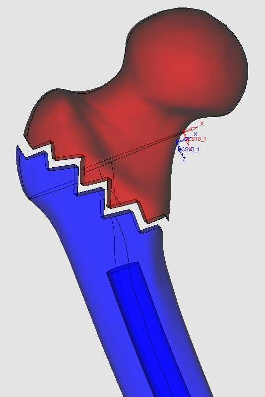 The main purpose of this study was to investigate some fixation devices from mechanical point of view, taking into account the stress and strain state, the total deformation and the processes in the