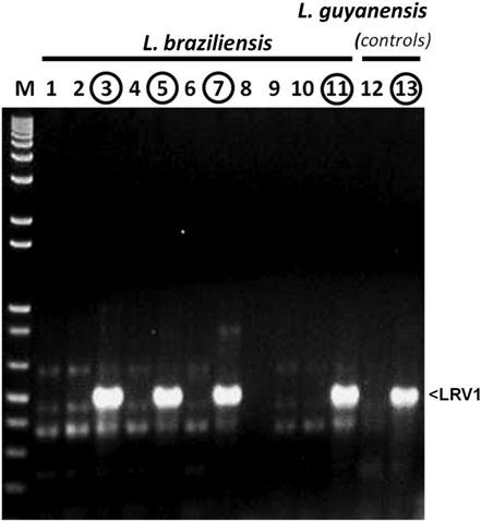 Figure 2. Reverse transcription polymerase chain reaction (PCR) detection of LRV1 in Leishmania braziliensis.