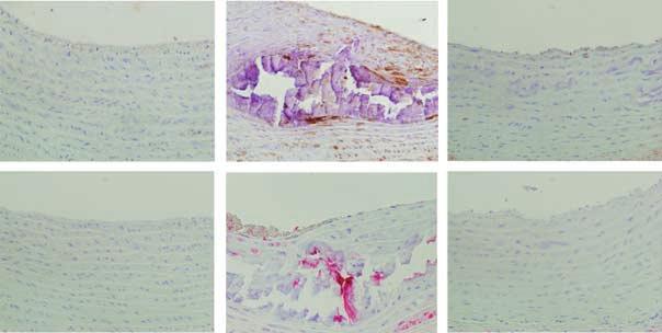 T Kawata et al.: Cinacalcet suppresses aortic, heart calcification o r i g i n a l a r t i c l e compared with sham-operated rat (Figure 5).