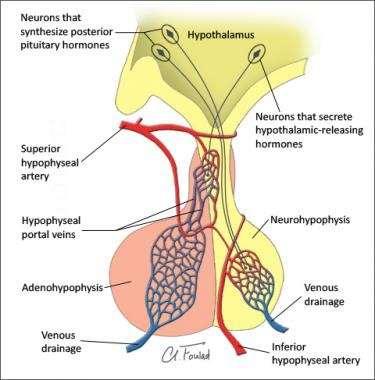 Pituitary Apoplexy - Pathophysiology