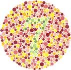 Figure 1 Left to right top: Ishihara plate showing the number 12 that can be seen by all, plate showing the number 6, which can be misread as 5 by red-green deficient individuals.