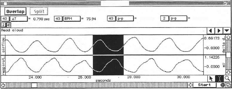 The following figure shows an example of selecting the total duration of one cycle. The ΔT measurement displays the total duration and BPM indicates the breathing rate of the selected cycle.