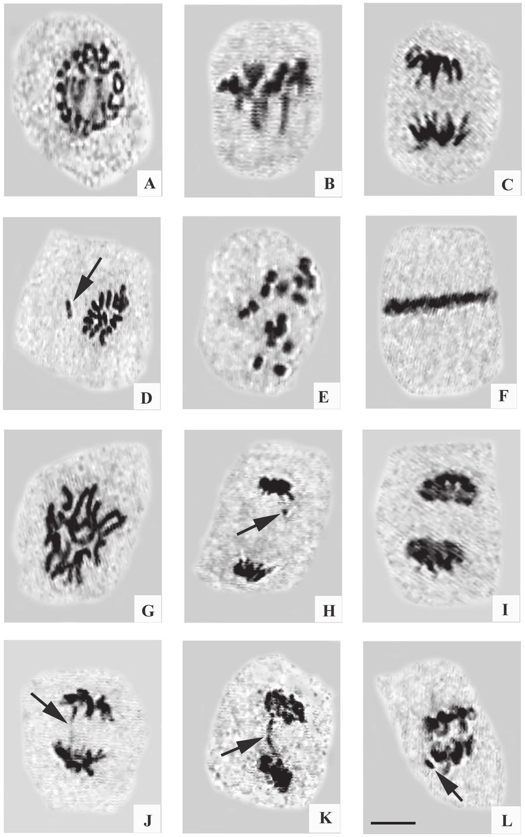 82 KUMAR AND DWIVEDI Fig. 1. Effects of heavy metals in chromosomes of Trachyspermum ammi (L.) Sprague. A. Prophase., B. Normal metaphase (2n=18). C. Normal anaphase (18:18). D. Precocious movement of chromosome at metaphase.
