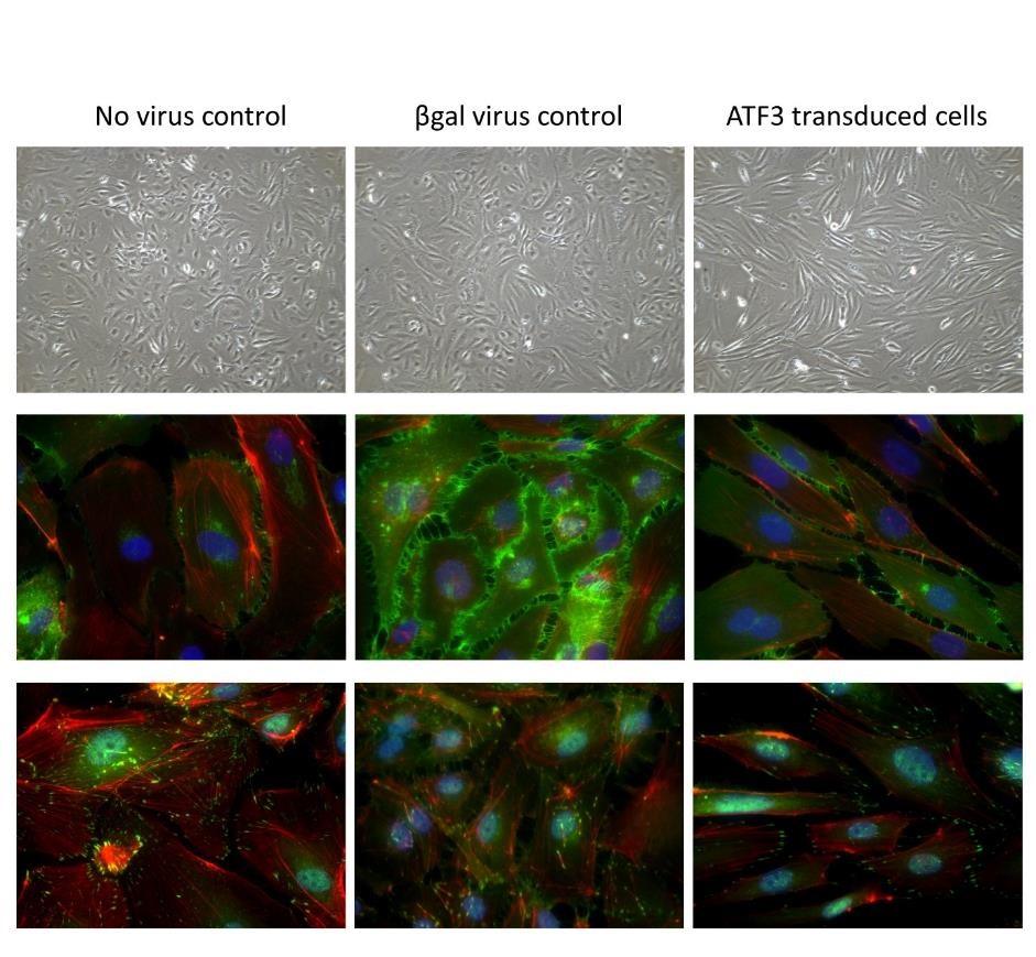 Supplementary figure 7. ATF3 overexpression consistently induced a morphological change in endothelial cells.