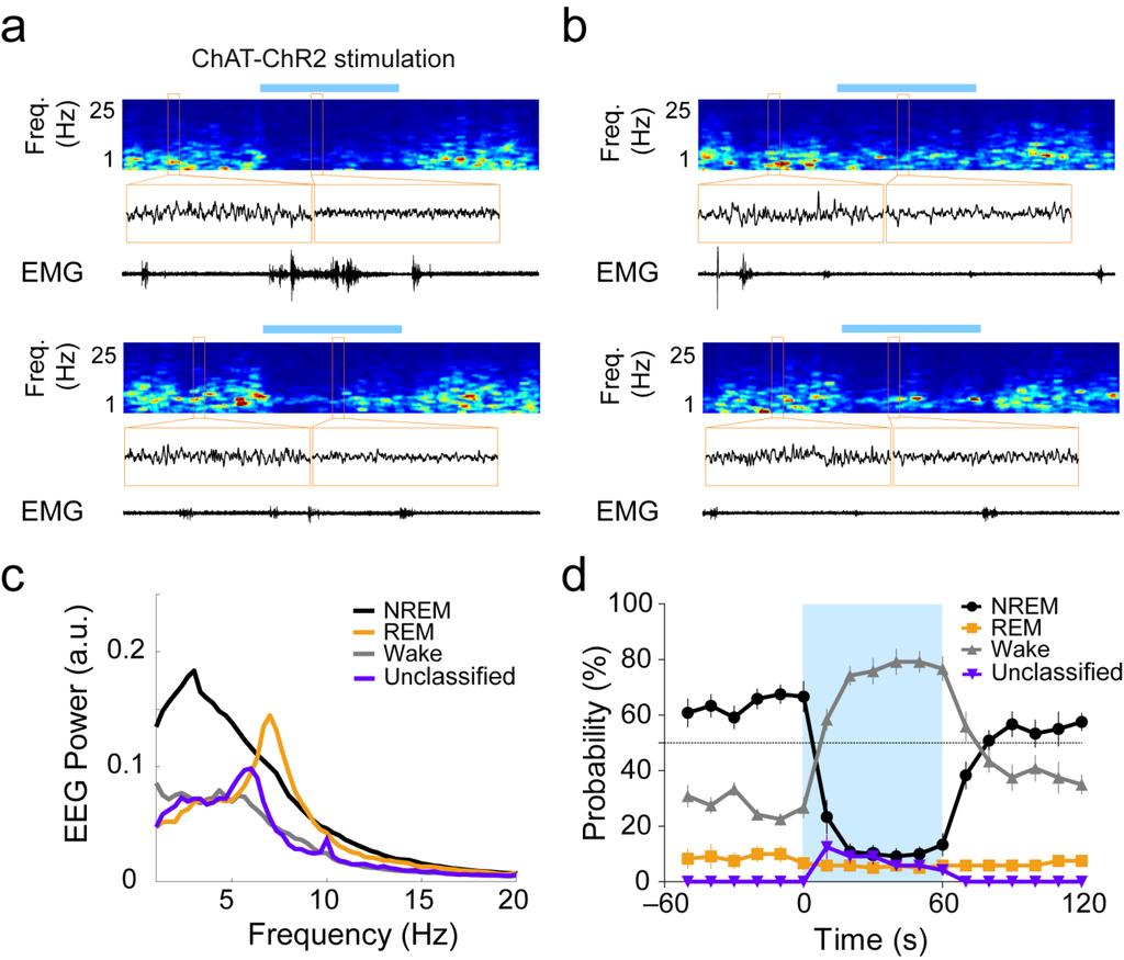 Supplementary Figure 5 Unclassified brain state induced by optogenetic activation of cholinergic BF neurons. a. Example trials in which laser stimulation induced wakefulness of ChAT-ChR2 mice.
