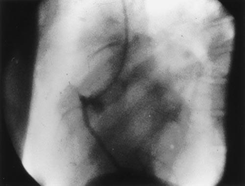 The First Coronary Angiogram Figure