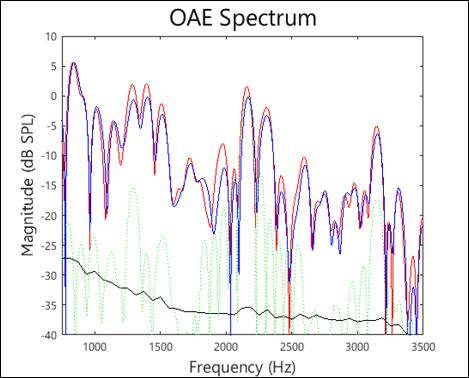 MEDIAL OLIVOCOCHLEAR EFFECTS ON COCHLEAR VIBRATION 11 frequency composition, only a narrow band of frequencies is to be chosen.