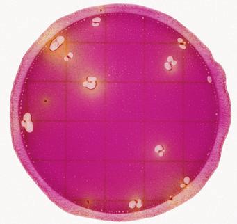 1 Bacteria producing gas and/or acid are considered to be presumptive Enterobacteriaceae and will have one of the following characteristics on the 3M Petrifilm Enterobacteriaceae Count plate: