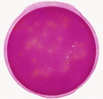 Figure 10 Enterobacteriaceae Count = 2 Food particles are often irregularly shaped or filamentous and are not associated with gas bubbles or acid zones (see