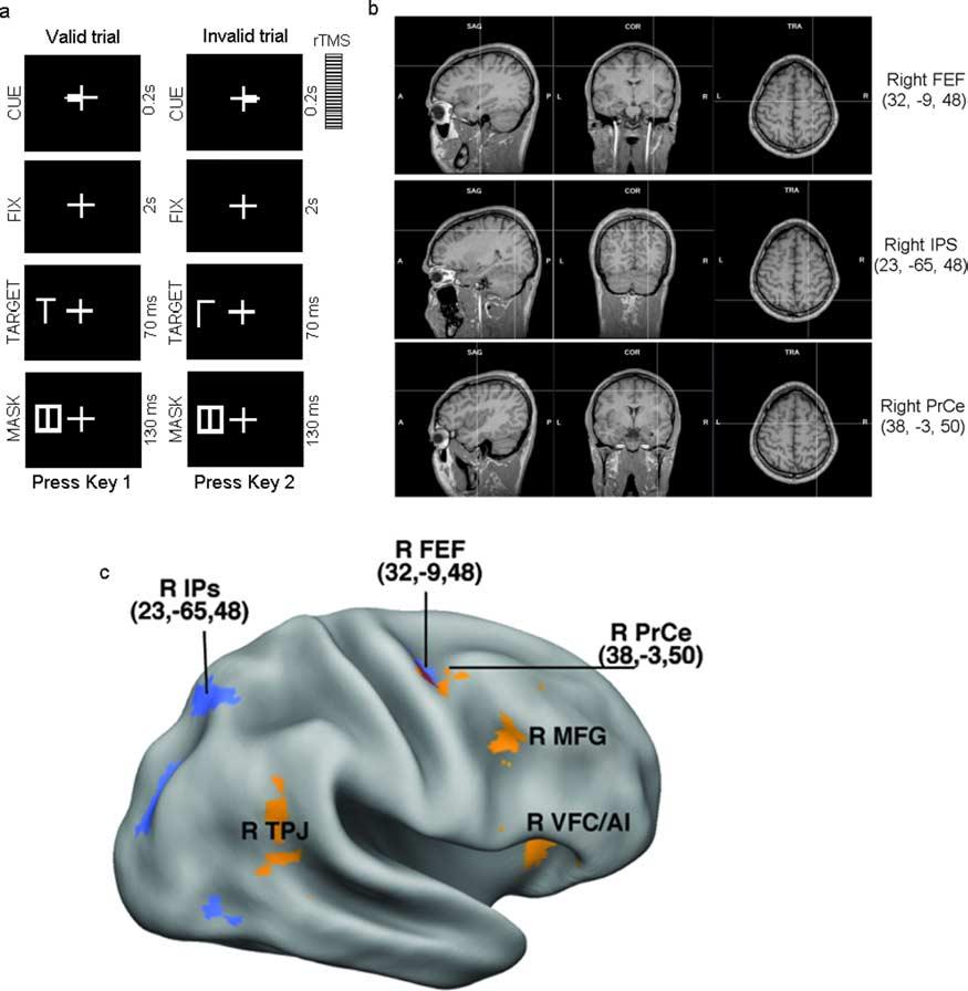 5864 J. Neurosci., May 6, 2009 29(18):5863 5872 Capotosto et al. Frontoparietal Cortex and Spatial Attention Figure 1. Task and rtms localization. a, Sequence of events during a trial.