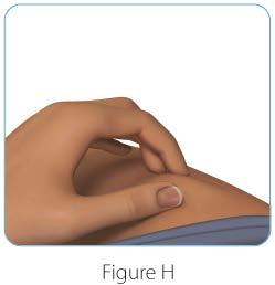 With yur ther hand, firmly hld the needle cver and pull the needle cver straight ff the needle (See Figure G).