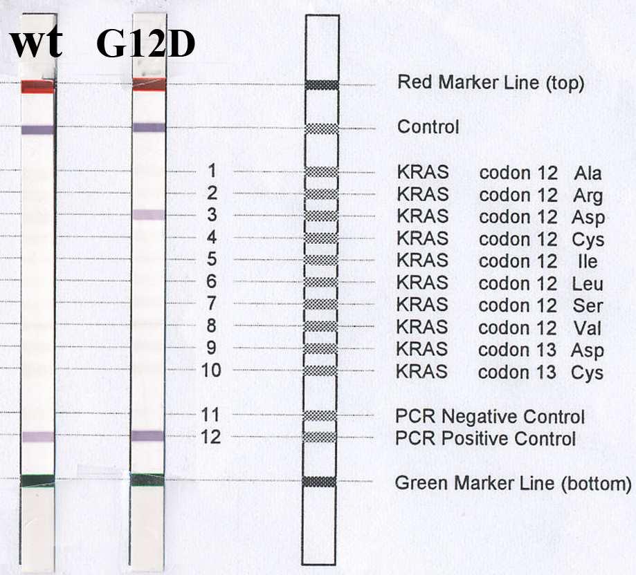 Primeri rezultata dobijenih reverznom hibridizacijom za KRAS wt i mutirani uzorak prikazani su na Slici 22.