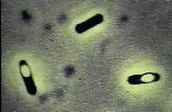 Listeria monocytogenes Staphylococcus aureus