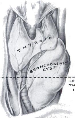 " Unfortunately, many enlargements of the thyroid gland do not contain functional tissue FIG. 9 FIG. 10 FIG. 11 FIG.