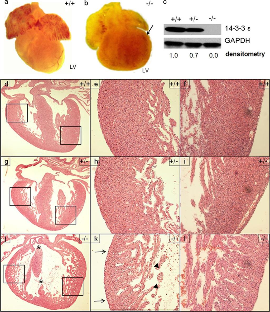 Kosaka et al. histone H3 phosphorylated at serine 10 (PH3), was significantly decreased in 14-3-3 / hearts (Fig.