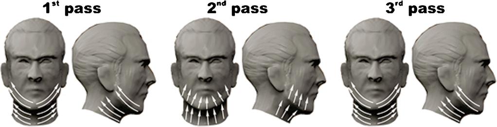 464 CLEMENTONI AND MUNAVALLI TABLE 2. HiFR Settings for Laxity of the Lower Third of the Face and Neck (Developed by MTC, Validated by GM). Passes 1 2 3 1 2 3 Depth (mm) 1.5 2.0 1.0 1.5 0.75 1.