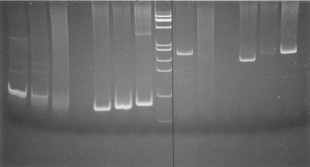 PCR method is gradually becoming the standard however its sensitivity (60%) is significantly lower compared to the Southern (95%) method.