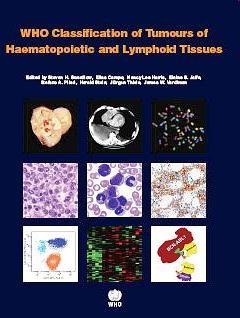 Molecular Classification of Tumors WHO Classification of Tumours of Haematopoietic and Lymphoid Tissues Swerdlow, S.H., Campo, E., Harris, N.L., Jaffe, E.S., Pileri, S.A., Stein, H., Thiele, J.