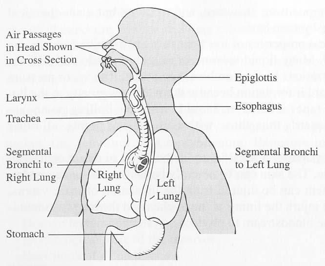 Route of body entry (cont) When air and its contaminates are inhaled, they first pass through the upper